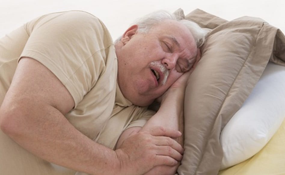 People affected with obesity & sleep apnea