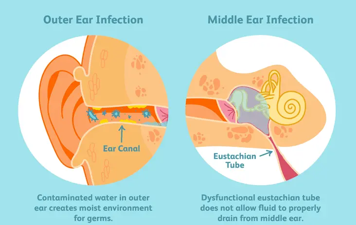 Sleep with Infection Tips Tricks