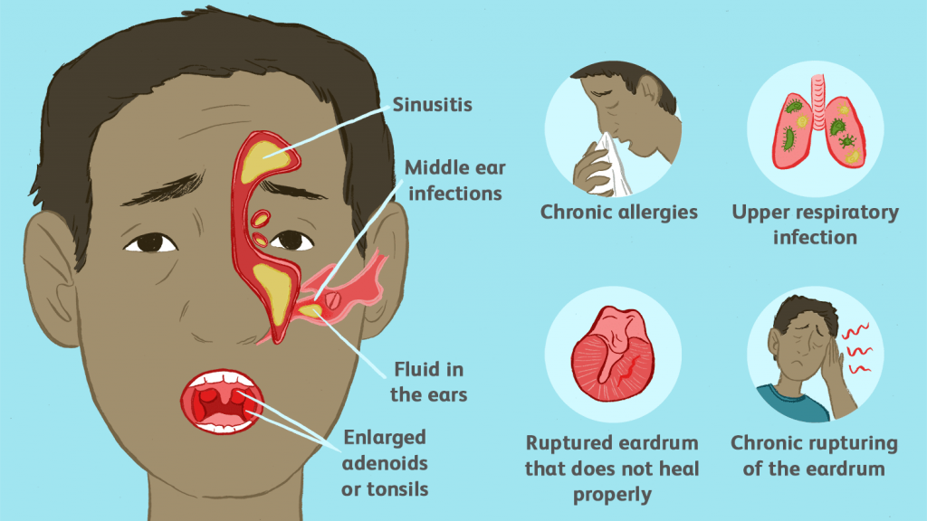 How To Chart Ear Infection