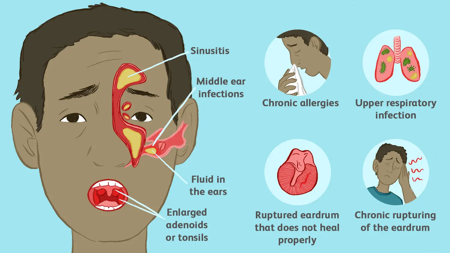 Sleep with Infection Tips Tricks