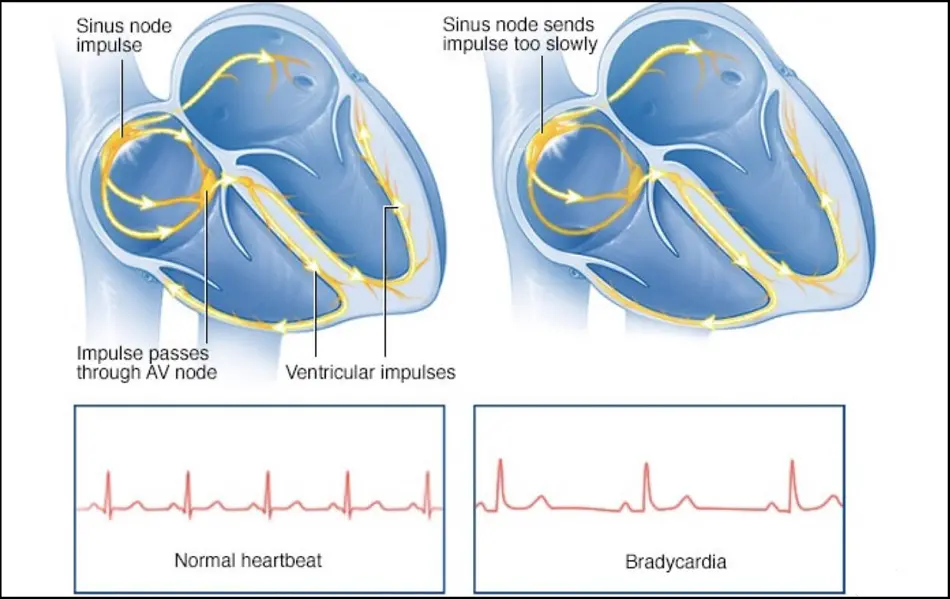 Average Resting Heart Rate Age: Important