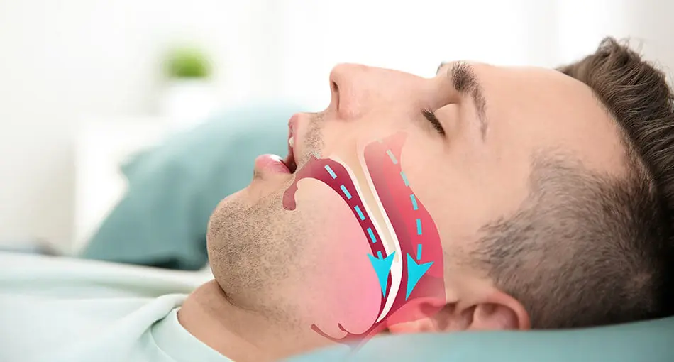 Sleeping Positions Sleep Apnea: Which Best?