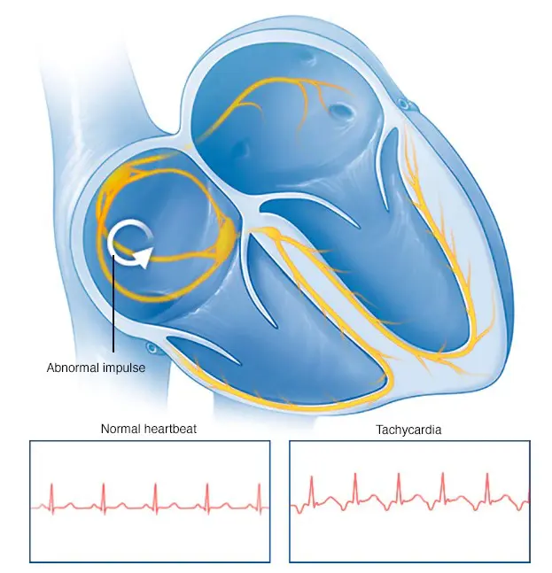 Average Resting Heart Rate Age: Important