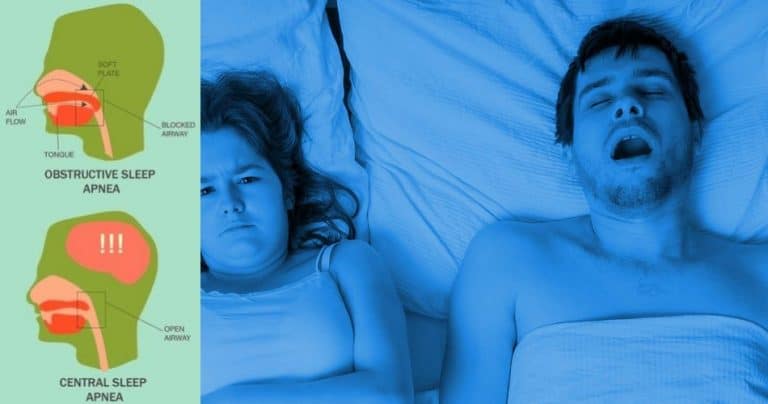 different types of sleep apnea