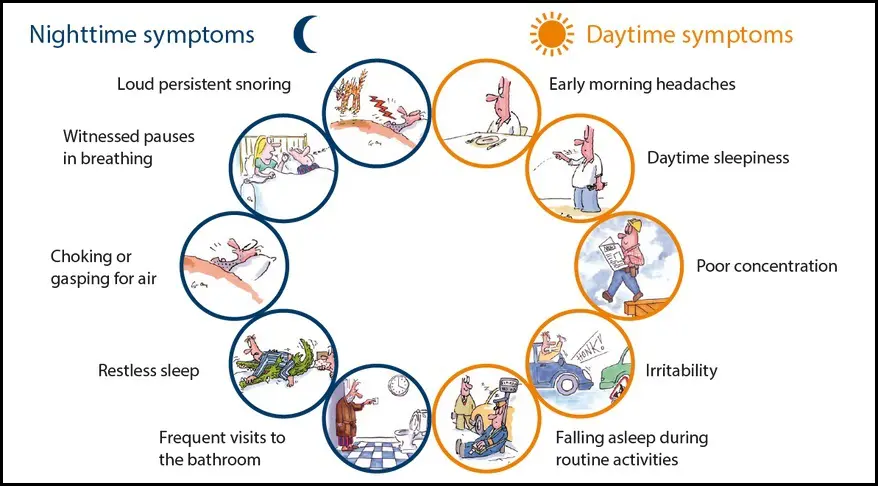 Sleep Apnea Snoring: Tell From Another?