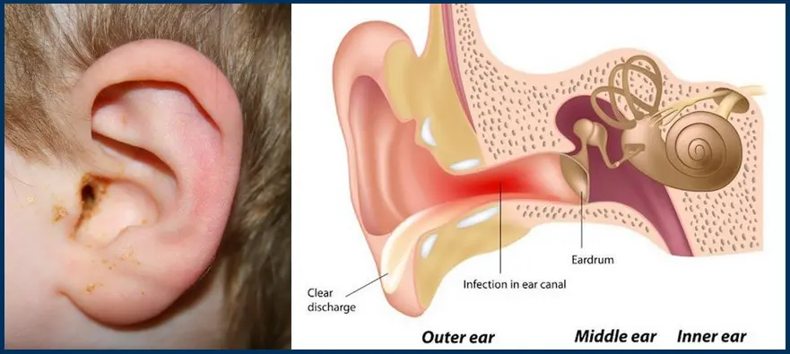 Sleep with Infection Tips Tricks