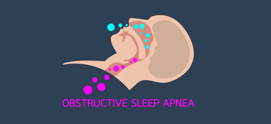 Main Types Sleep Apnea Explained：Obstructive Central