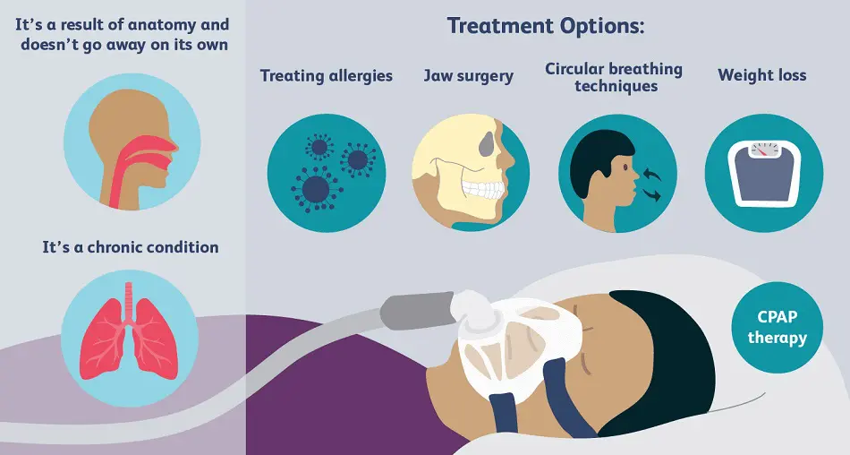 Sleeping Positions Sleep Apnea: Which Best?