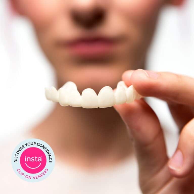 My Experience Trying Instasmile Clip-On Veneers