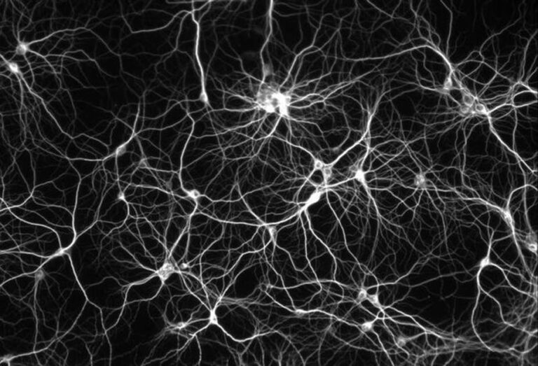 A Beginner&lsquo;s Guide to Artificial Neural Networks