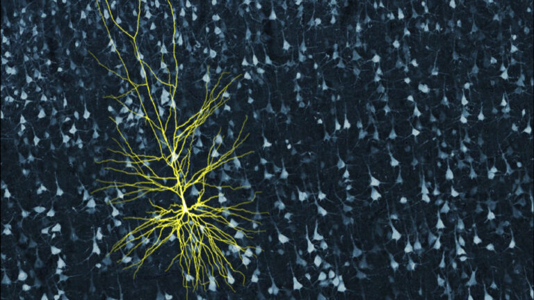 Gearing Up to Dive into the Mariana Trench of Deep Learning