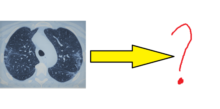 Detecting COVID-19 from CT Scans Using Deep Learning: A Comprehensive Review
