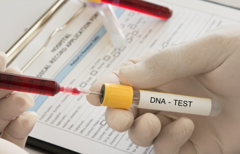 Can You Register Your Dog With a DNA Test? A Dog Lover&lsquo;s Guide to Genetic Testing and Registration